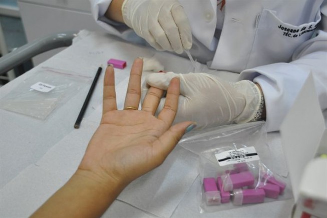 Em 12 anos, 1.213 exames positivos de aids no CTA