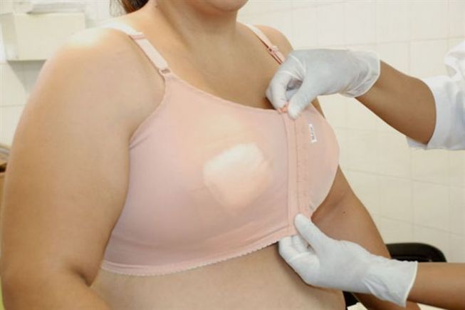 Mulheres com seios gigantes podem fazer redução gratuitamente 