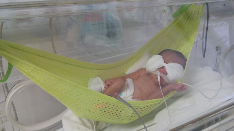 HEC utiliza redinhas para recuperação de bebês prematuros