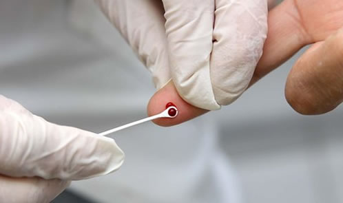 Confirmados 15 casos de sífilis e 3 de HIV em Feira