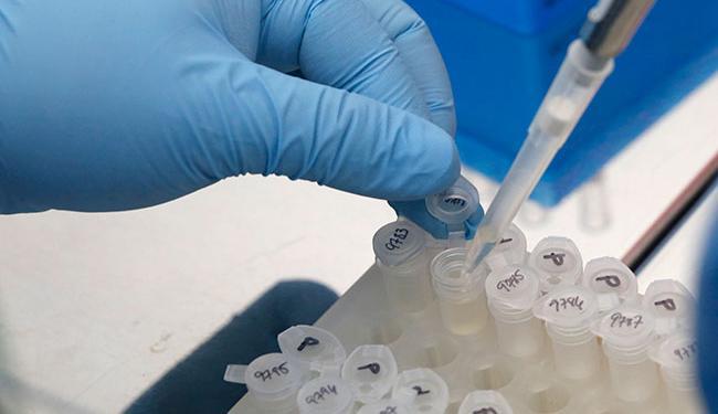 Pesquisadores buscam soro para combater zika