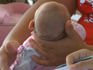 Instituto cria grupo de atendimento à crianças com microcefalia em Salvador