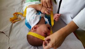Fetos infectados pelo Zika tem de 1 a 13% de chances de desenvolver microcefalia