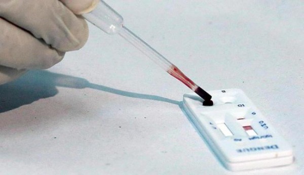 Bahia produz o primeiro teste rápido da zika no Brasil