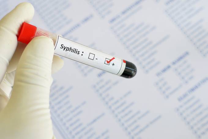 Ministro da Saúde admite que Brasil vive uma epidemia de sífilis