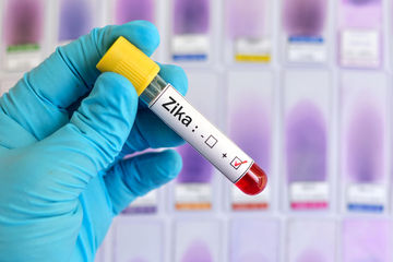 Ministério da Saúde vai distribuir 3,5 milhões de testes rápidos de zika