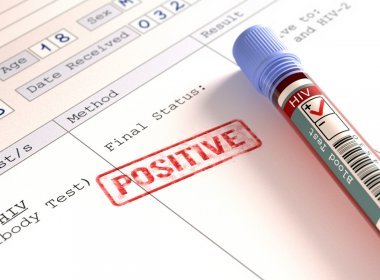 Ministério afirma que 260 mil brasileiros sabem de infecção por HIV, mas não se tratam