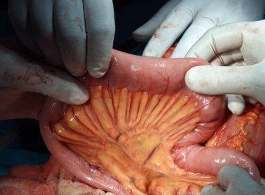 Pesquisadores descobrem um novo órgão do corpo humano