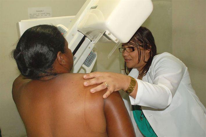 Mulheres estão fazendo menos exames de mamografia em Feira