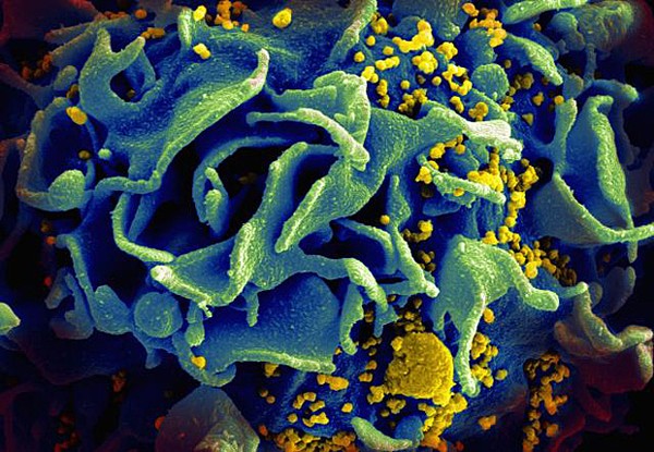 Casos de infecção por HIV crescem 3% no Brasil desde 2010, diz Unaids