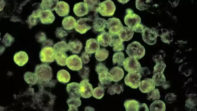 Infecção rara, causada por ameba comedora de cérebro, mata homem, nos EUA   