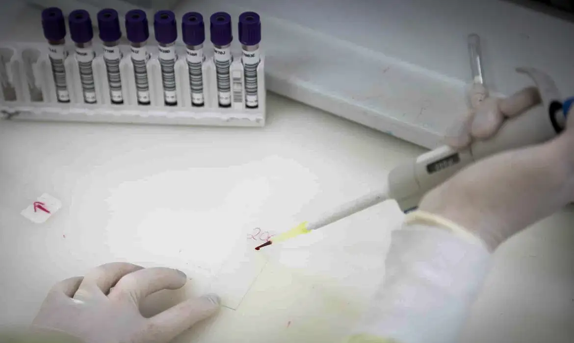 Paciente com suspeita de ebola testa positivo para meningite; caso ocorreu em São Paulo